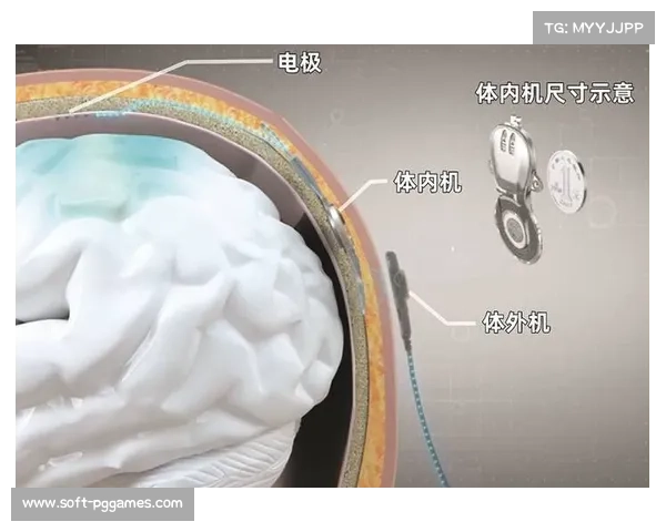 脑机接口技术前景 探索终极互动